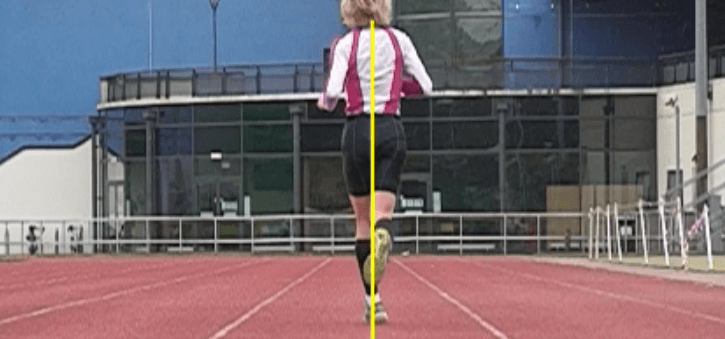 ITB Syndrome Rehab: Running Step Width Modification