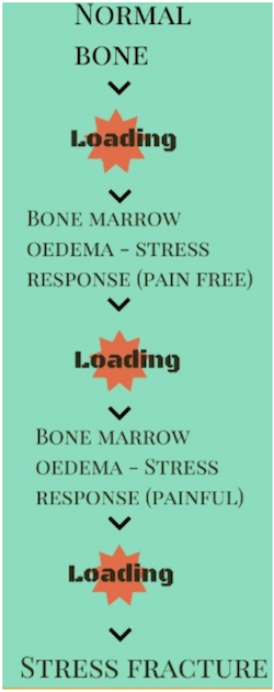 Runner's Guide to Stress Fracture Rehab