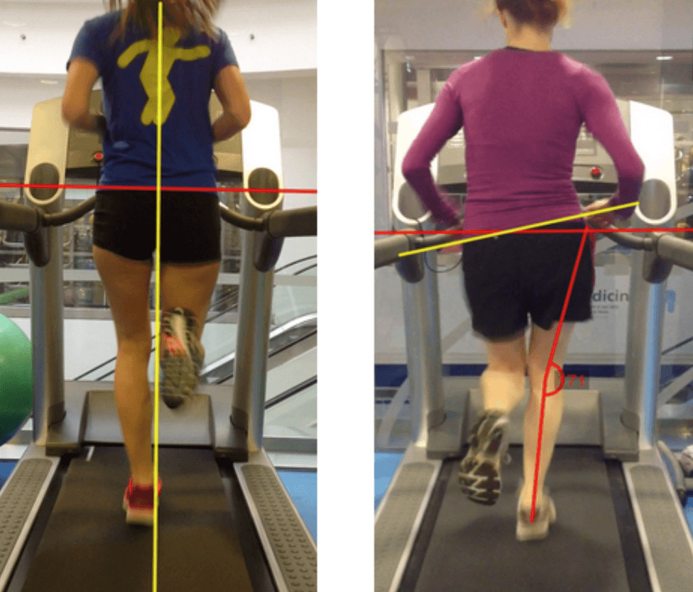 Runners with patellofemoral pain have altered biomechanics which targeted interventions can modify: A systematic review and meta-analysis