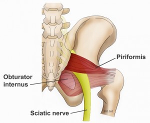 Piriformis Syndrome: Symptoms, Causes, Treatment & Prevention