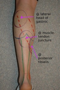 Achilles Tendon and Calf Anatomy