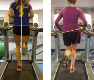 Runners with patellofemoral pain have altered biomechanics which targeted interventions can modify: A systematic review and meta-analysis