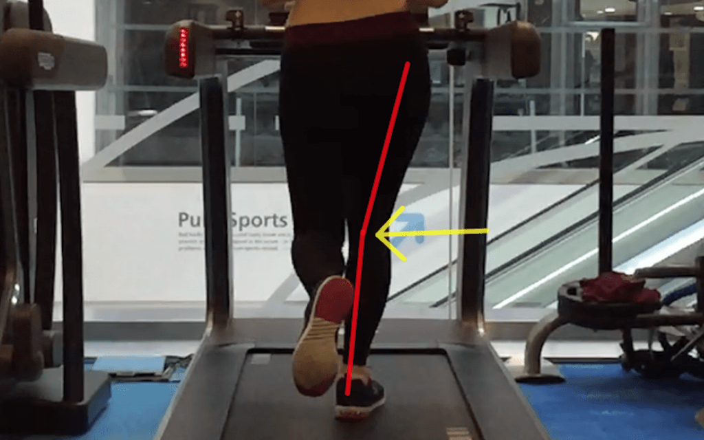 Gait Retraining for Runner's Knee Patellofemoral Pain & Running Form