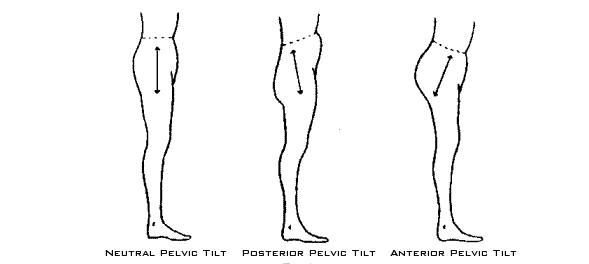 Pelvic Tilt