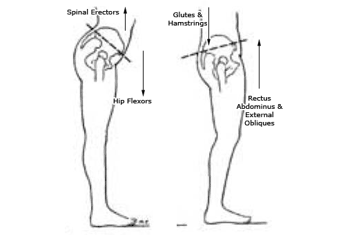 Pelvic Muscle Imbalances