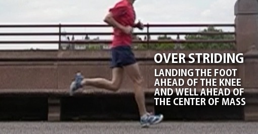 Over0striding runner Patellofemoral Pain Syndrome - Over-striding runner